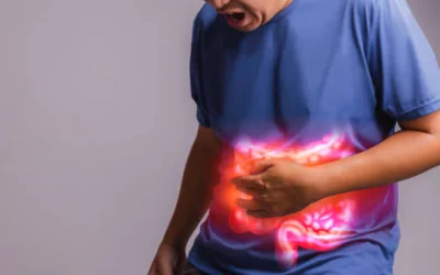 Irritable Bowel Syndrome (IBS)